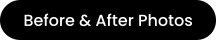 Before & After Photos
